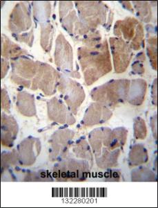 Anti-RPS6KC1 Rabbit Polyclonal Antibody