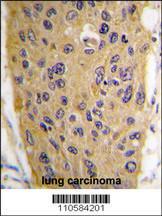 Anti-WIF1 Rabbit Polyclonal Antibody (HRP (Horseradish Peroxidase))