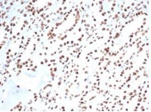 Immunohistochemical analysis of formalin-fixed, paraffin-embedded human kidney tissue using Anti-Ku80 Antibody [XRCC5/7317]