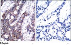 Anti-STMN1 Rabbit Polyclonal Antibody