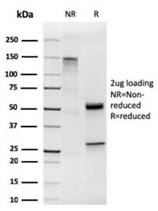 SDS-PAGE analysis of Anti-Cytokeratin 19 Antibody [KRT19/1959R] under non-reduced and reduced conditions; showing intact IgG and intact heavy and light chains, respectively SDS-PAGE analysis confirms the integrity and purity of the antibody