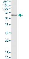 Anti-MGAT4B Polyclonal Antibody Pair