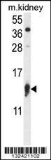 Anti-RPS12 Rabbit Polyclonal Antibody (PE (Phycoerythrin))