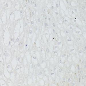 Immunohistochemistry analysis of paraffin-embedded human esophageal using Anti-p53 Antibody (A308277) at a dilution of 1:100 (40X lens). Perform microwave antigen retrieval with 10 mM PBS buffer pH 7.2 before commencing with IHC staining protocol