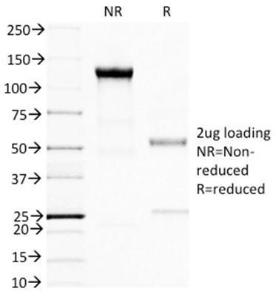 Antibody anti-BRCA1 BRCA11398 100 µg