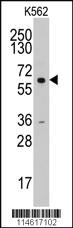 Anti-CCNA2 Rabbit Polyclonal Antibody