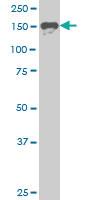 Anti-SUPT5H Mouse Monoclonal Antibody [clone: 1G3]