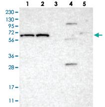 Anti-IFFO2 Rabbit Polyclonal Antibody