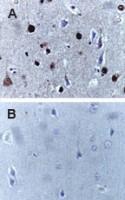 Anti-CASP9 Rabbit Polyclonal Antibody