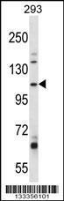 Anti-B4GALNT3 Rabbit Polyclonal Antibody (FITC (Fluorescein Isothiocyanate))