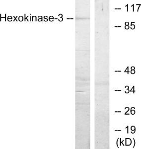 Western blot analysis of lysates from Jurkat cells, treated with insulin 0.01U/ml 15' using Anti-Hexokinase-3 Antibody. The right hand lane represents a negative control, where the antibody is blocked by the immunising peptide.