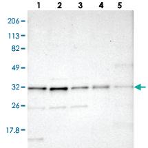 Anti-STX17 Rabbit Polyclonal Antibody