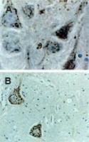 Anti-CASP9 Rabbit Polyclonal Antibody