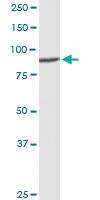 Anti-DDX50 Rabbit Polyclonal Antibody