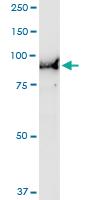 Anti-USP10 Polyclonal Antibody Pair