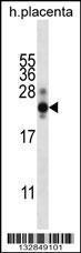 Anti-Chorionic Gonadotropin, Human, beta CT Rabbit Polyclonal Antibody (APC (Allophycocyanin))