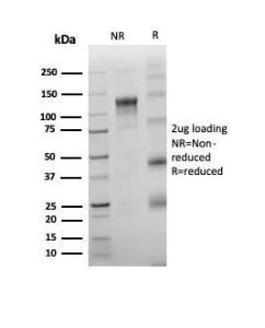 SDS-PAGE analysis of Anti-TdT Antibody [rDNTT/6909] under non-reduced and reduced conditions; showing intact IgG and intact heavy and light chains, respectively. SDS-PAGE analysis confirms the integrity and purity of the antibody.