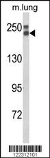 Anti-COL18A1 Rabbit Polyclonal Antibody