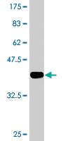 Anti-ILKAP Mouse Monoclonal Antibody [clone: 3B5]