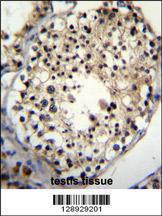 Anti-ALKBH6 Rabbit Polyclonal Antibody (HRP (Horseradish Peroxidase))