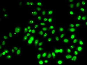 Immunofluorescence analysis of HeLa cells using Anti-p53 Antibody (A308277)