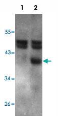 Anti-RCAN1 Goat Polyclonal Antibody