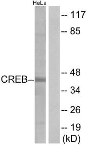 Anti-CREB + CREM Rabbit Polyclonal Antibody