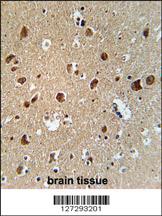 Anti-GCDH Rabbit Polyclonal Antibody