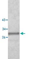 Anti-AQP9 Rabbit Polyclonal Antibody