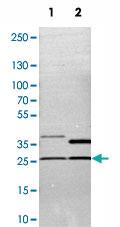 Anti-STX17 Rabbit Polyclonal Antibody