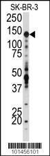 Anti-Insulin-Like Growth Factor I Receptor Rabbit Polyclonal Antibody (HRP (Horseradish Peroxidase))