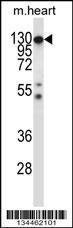 Anti-CSF1R Rabbit Polyclonal Antibody (HRP (Horseradish Peroxidase))