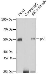 Immunoprecipitation analysis of 200µg extracts of 293T cells using 3 µg of Anti-p53 Antibody (A308277). This Western blot was performed on the immunoprecipitate using Anti-p53 Antibody (A308277) at a dilution of 1:1000