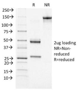 SDS-PAGE analysis of Anti-BRCA1 Antibody [BRCA1/1472] under non-reduced and reduced conditions; showing intact IgG and intact heavy and light chains, respectively SDS-PAGE analysis confirms the integrity and purity of the antibody