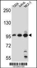 Anti-GCDH Rabbit Polyclonal Antibody