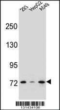 Anti-ZNF569 Rabbit Polyclonal Antibody