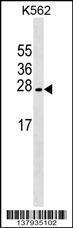 Anti-LZIC Rabbit Polyclonal Antibody (PE (Phycoerythrin))