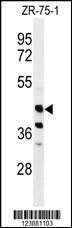 Anti-FA2H Rabbit Polyclonal Antibody (APC (Allophycocyanin))