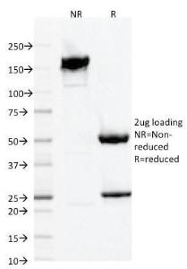 SDS-PAGE analysis of Anti-Iba1 Antibody [AIF1/1909] under non-reduced and reduced conditions; showing intact IgG and intact heavy and light chains, respectively SDS-PAGE analysis confirms the integrity and purity of the antibody