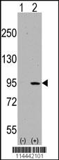 Anti-DDR1 Rabbit Polyclonal Antibody