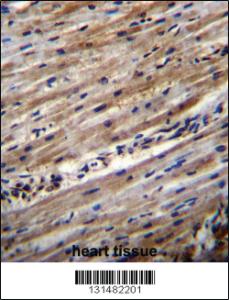 Anti-DUS1L Rabbit Polyclonal Antibody