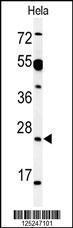 Anti-AKIRIN1 Rabbit Polyclonal Antibody (HRP (Horseradish Peroxidase))