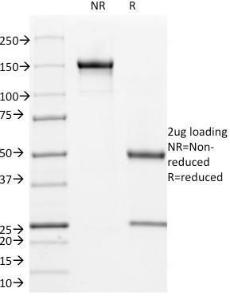 SDS-PAGE analysis of Anti-L1CAM Antibody [UJ127] under non-reduced and reduced conditions; showing intact IgG and intact heavy and light chains, respectively. SDS-PAGE analysis confirms the integrity and purity of the antibody