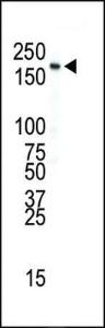 Anti-INSR Rabbit Polyclonal Antibody (AP (Alkaline Phosphatase))