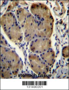 Anti-WDR86 Rabbit Polyclonal Antibody