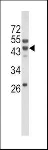 Anti-WNT10B Rabbit Polyclonal Antibody