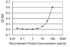 Anti-KRAS Mouse Monoclonal Antibody [clone: 1E4-1B10]