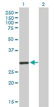 Anti-KCNRG Mouse Polyclonal Antibody