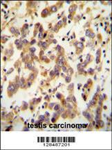 Anti-CT173 Rabbit Polyclonal Antibody (FITC (Fluorescein Isothiocyanate))