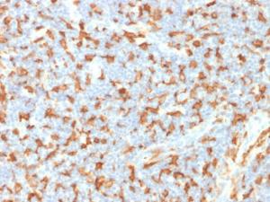 Immunohistochemical analysis of formalin-fixed, paraffin-embedded human lymph node using Anti-Iba1 Antibody [AIF1/1909]